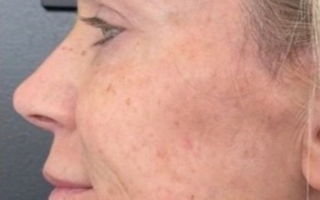 Neck or Décolletage